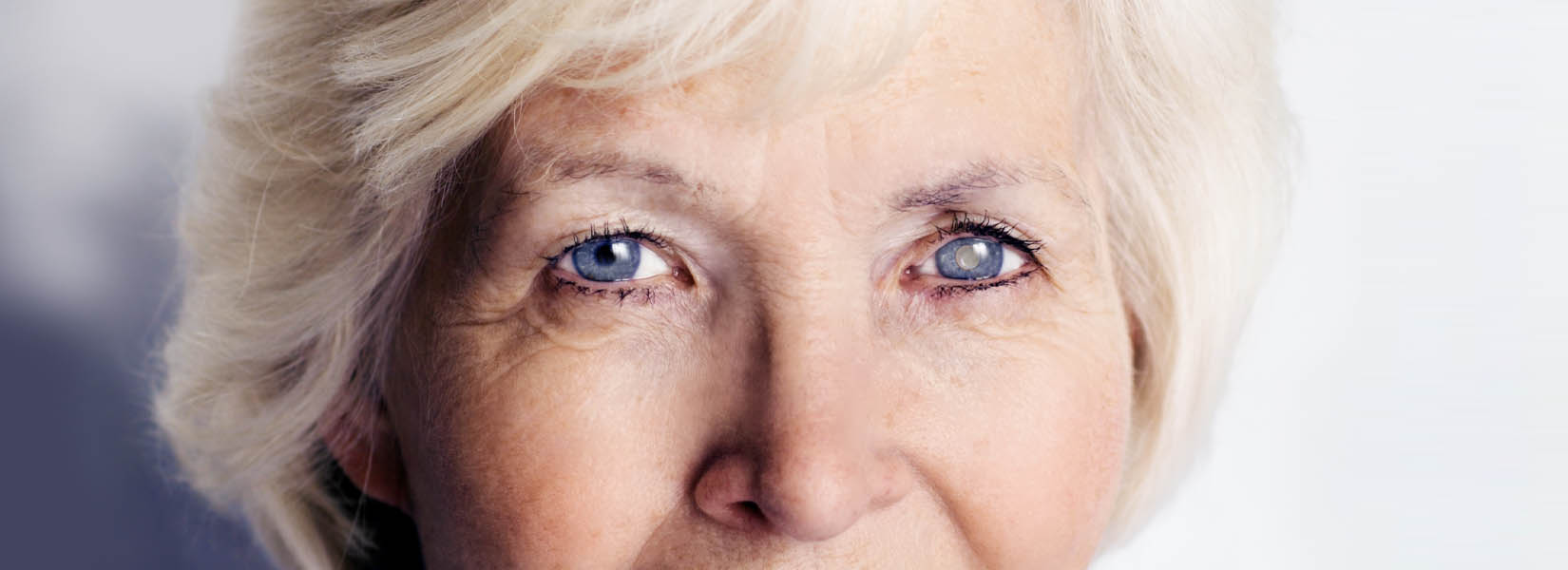 Cataract Surgery in Rockford
